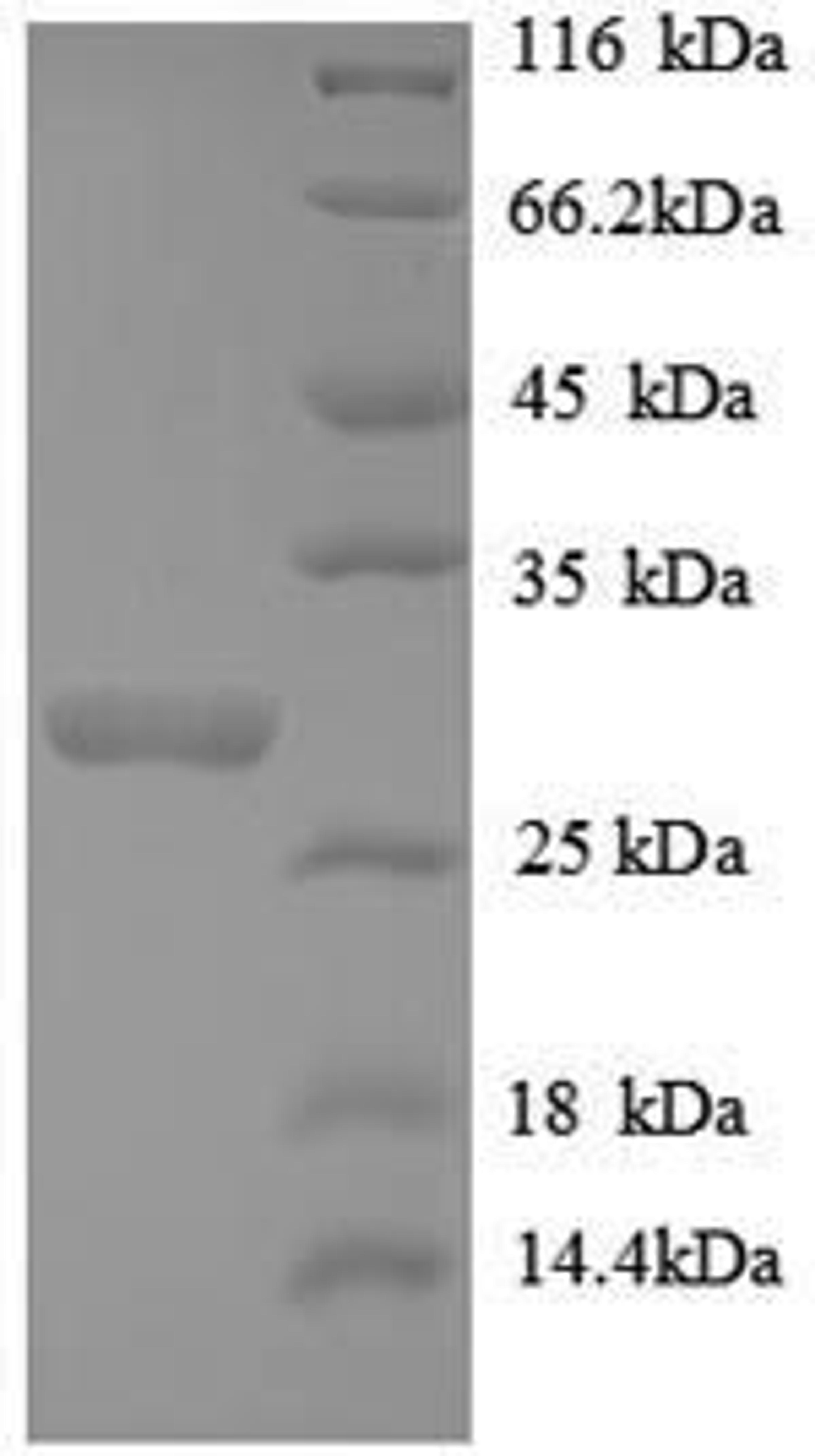 (Tris-Glycine gel) Discontinuous SDS-PAGE (reduced) with 5% enrichment gel and 15% separation gel.