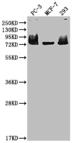 Western Blot. Positive WB detected in: PC-3 whole cell lysate, MCF-7 whole cell lysate, 293 whole cell lysate. All lanes: MEN1 antibody at 1:2000. Secondary. Goat polyclonal to rabbit IgG at 1/50000 dilution. Predicted band size: 69, 68, 64 kDa. Observed band size: 75 kDa. 