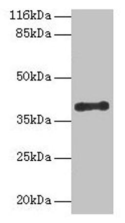 Western blot. All lanes: CYLC2 antibody at 12µg/ml + 293T whole cell lysate. Secondary. Goat polyclonal to rabbit IgG at 1/10000 dilution. Predicted band size: 40 kDa. Observed band size: 40 kDa