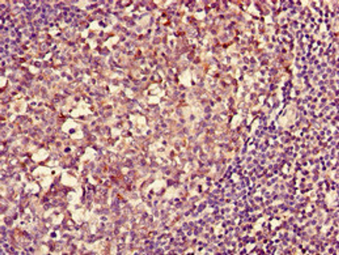 Immunohistochemistry of paraffin-embedded human tonsil tissue using CSB-PA14839D0Rb at dilution of 1:100