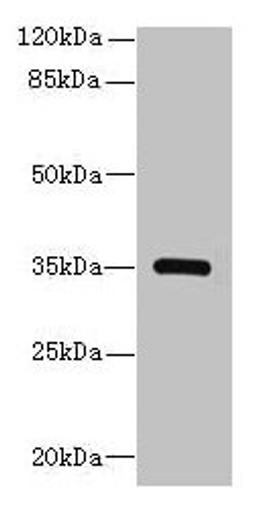 Western blot. All lanes: STX19 antibody at 2µg/ml + K562 whole cell lysate. Secondary. Goat polyclonal to rabbit IgG at 1/10000 dilution. Predicted band size: 35 kDa. Observed band size: 35 kDa