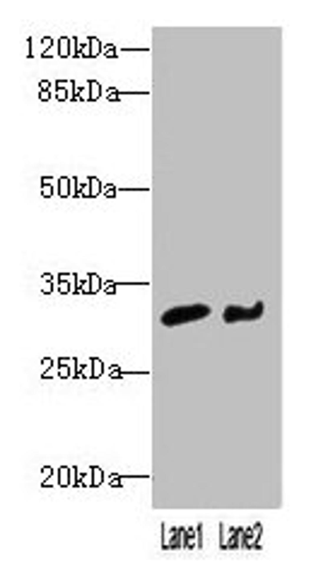 Western blot. All lanes: NIT2 antibody at 3ug/ml. Lane 1: Mouse heart tissue. Lane 2: A549 whole cell lysate. Secondary. Goat polyclonal to rabbit IgG at 1/10000 dilution. Predicted band size: 31 kDa. Observed band size: 31 kDa. 