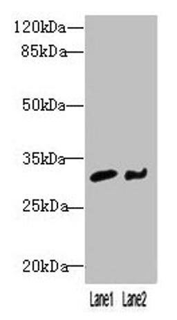 Western blot. All lanes: NIT2 antibody at 3ug/ml. Lane 1: Mouse heart tissue. Lane 2: A549 whole cell lysate. Secondary. Goat polyclonal to rabbit IgG at 1/10000 dilution. Predicted band size: 31 kDa. Observed band size: 31 kDa. 