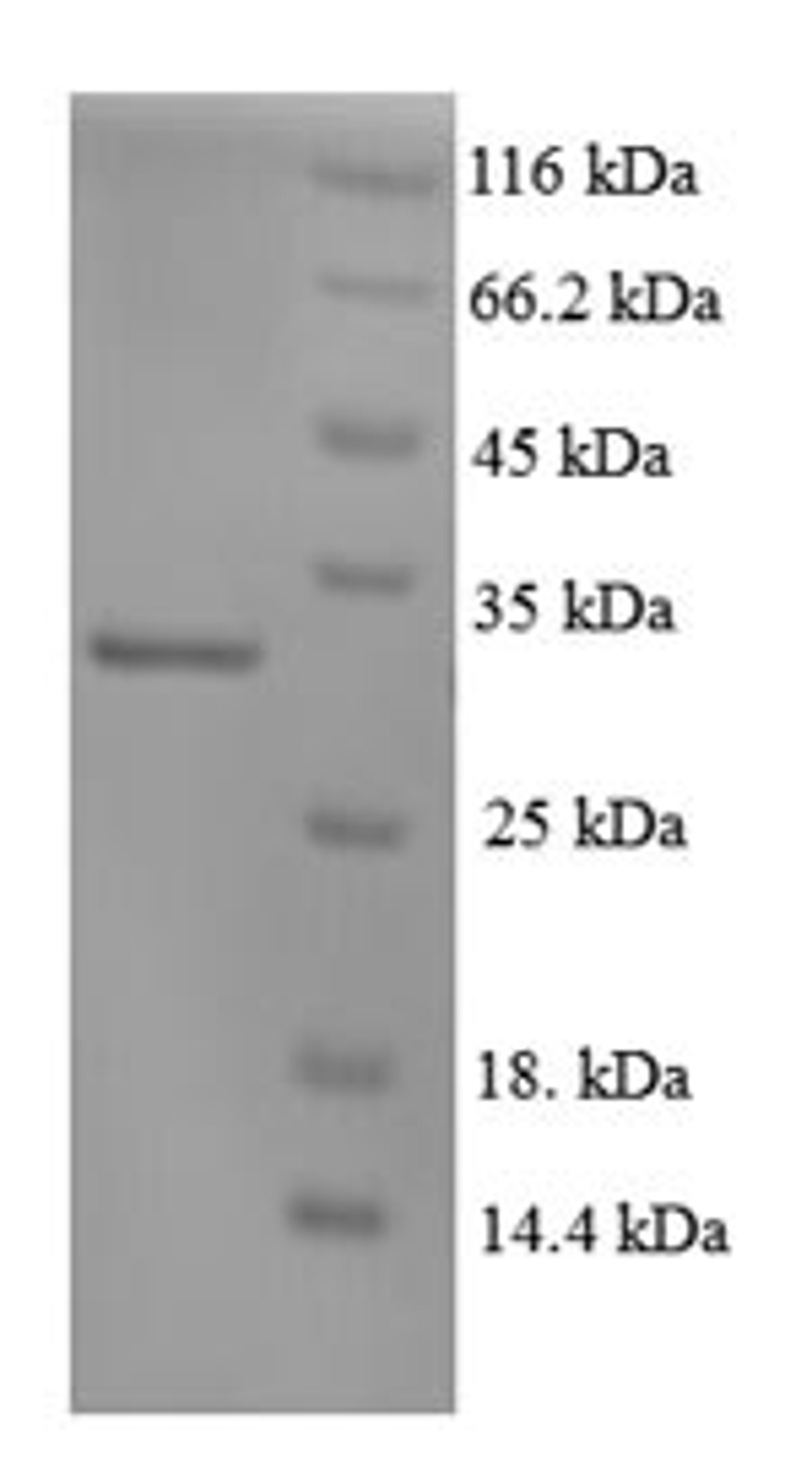 (Tris-Glycine gel) Discontinuous SDS-PAGE (reduced) with 5% enrichment gel and 15% separation gel.