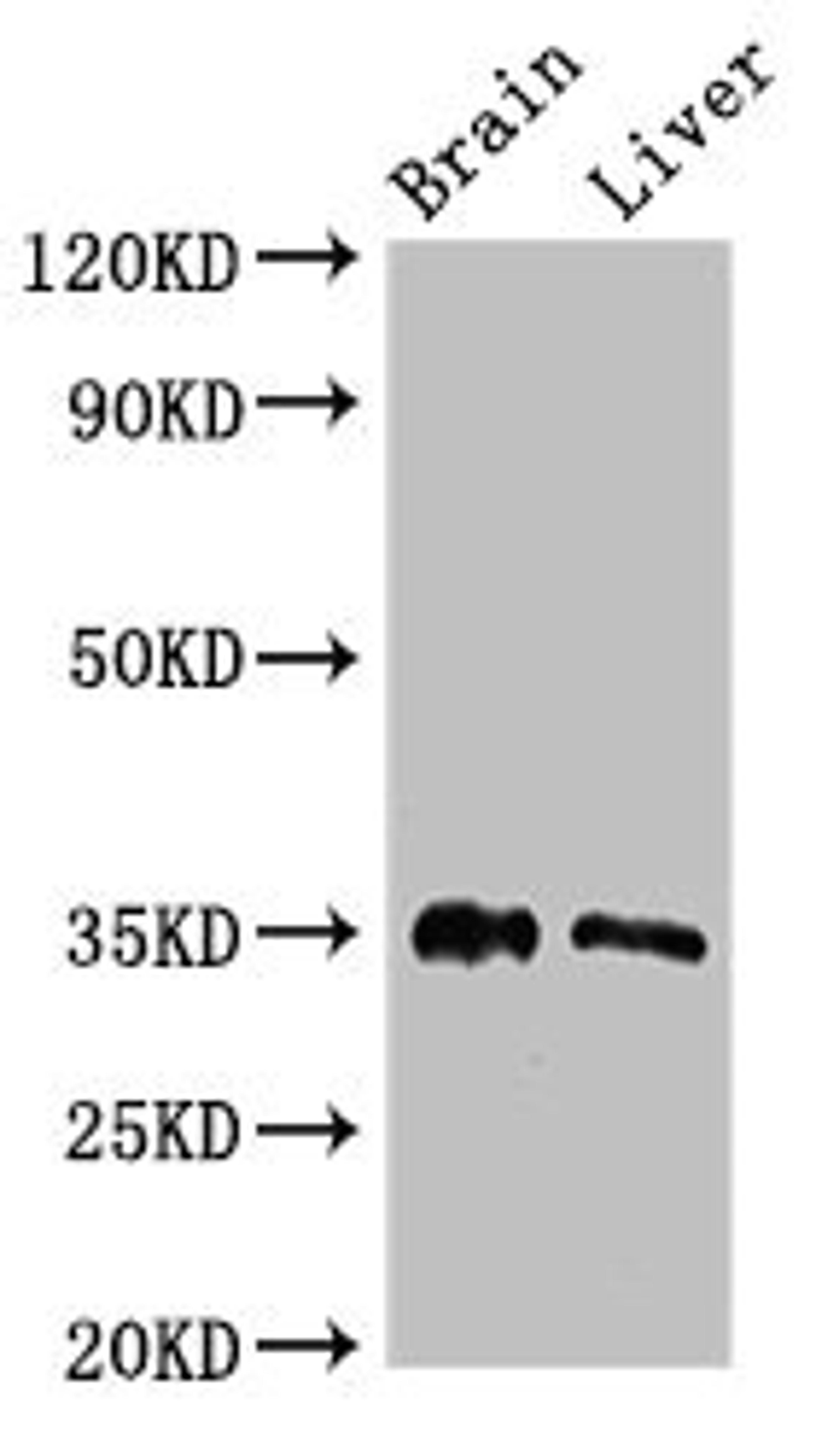 Western Blot. Positive WB detected in: Mouse brain tissue, Rat liver tissue. All lanes: PTF1A antibody at 2.7ug/ml. Secondary. Goat polyclonal to rabbit IgG at 1/50000 dilution. Predicted band size: 35 kDa. Observed band size: 35 kDa. 