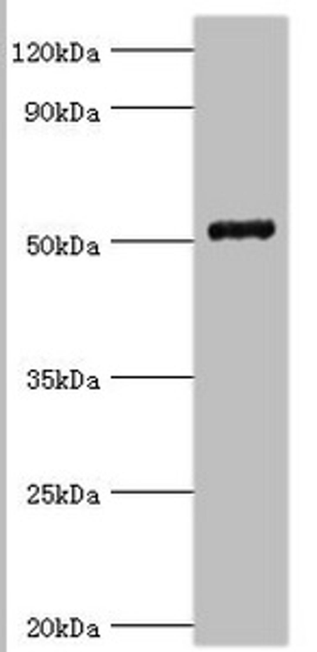 Western blot. All lanes: COP9 signalosome complex subunit 2 antibody at 6ug/ml + Mouse skeletal muscle tissue. Secondary. Goat polyclonal to rabbit IgG at 1/10000 dilution. Predicted band size: 52, 53 kDa. Observed band size: 52 kDa. 