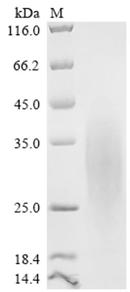 (Tris-Glycine gel) Discontinuous SDS-PAGE (reduced) with 5% enrichment gel and 15% separation gel.