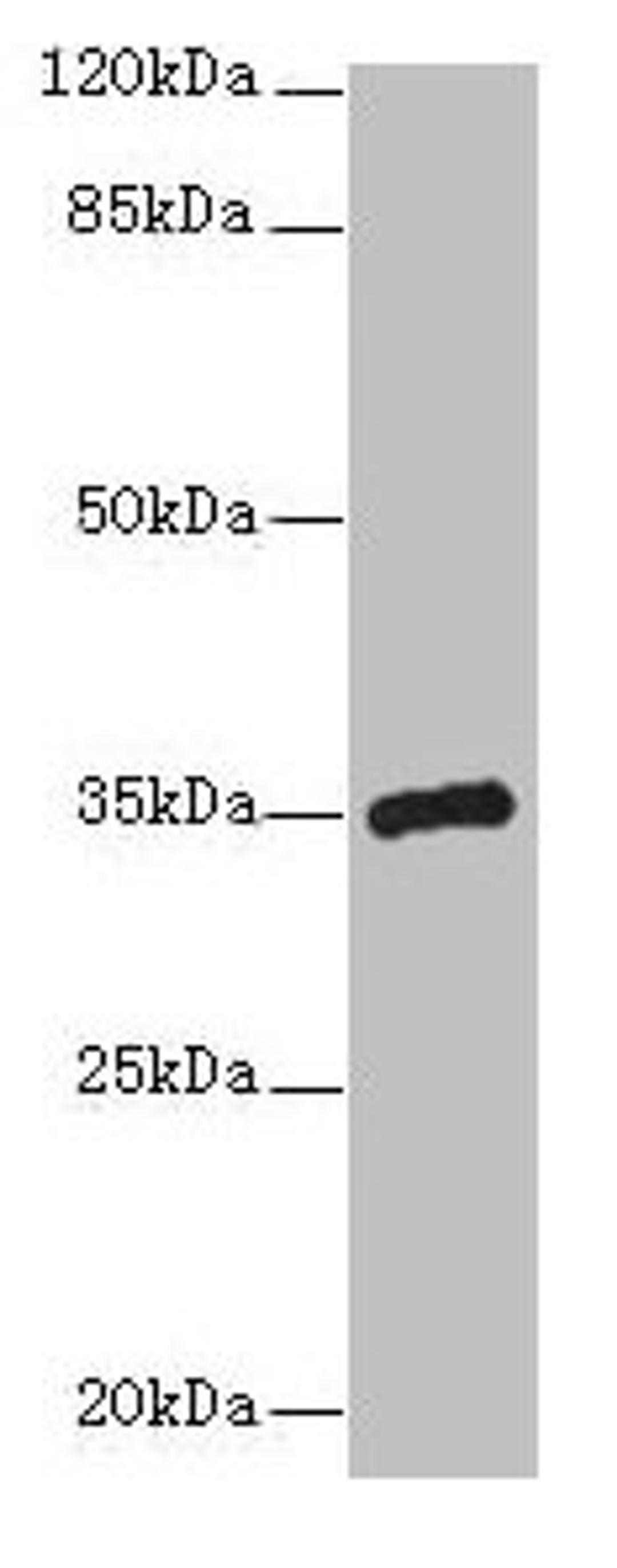 Western blot. All lanes: CPXCR1 antibody at 5µg/ml + Mouse brain tissue. Secondary. Goat polyclonal to rabbit IgG at 1/10000 dilution. Predicted band size: 35 kDa. Observed band size: 35 kDa
