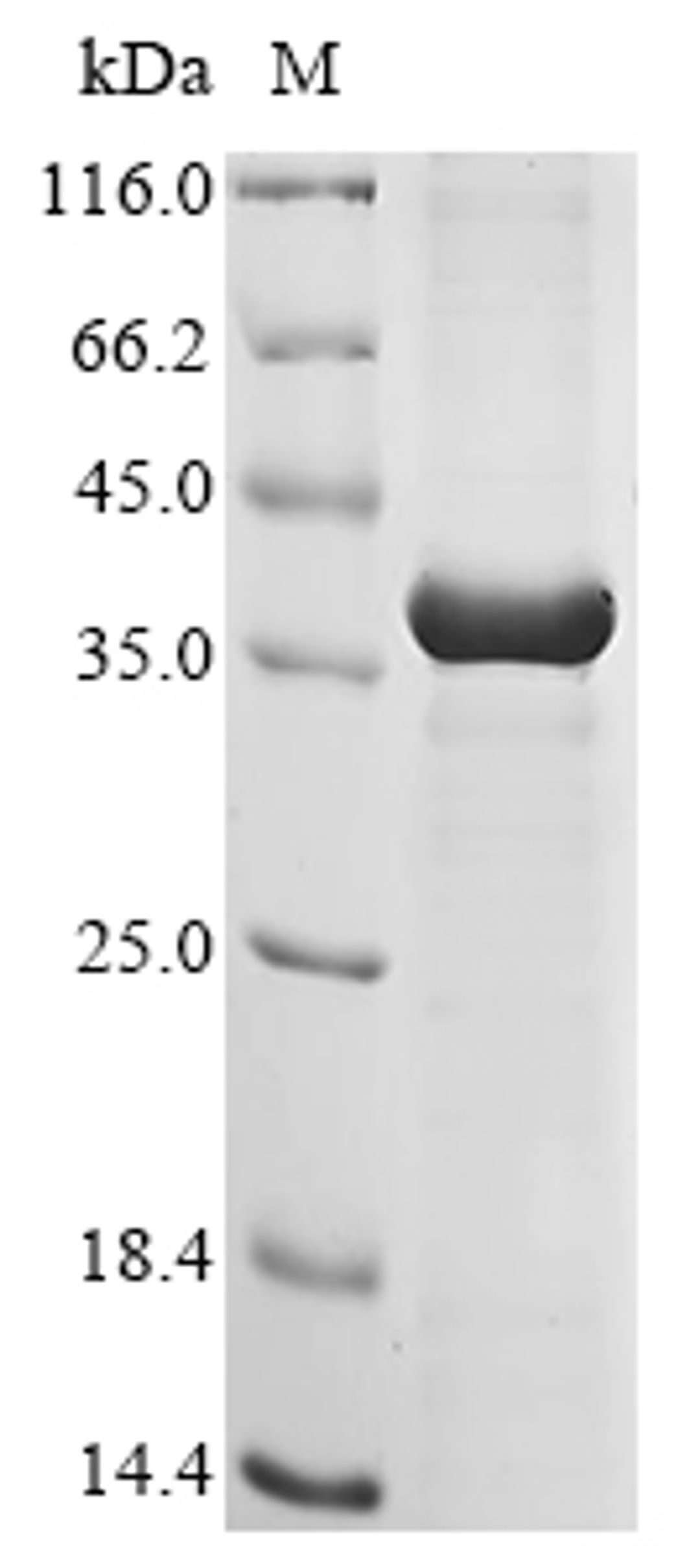 (Tris-Glycine gel) Discontinuous SDS-PAGE (reduced) with 5% enrichment gel and 15% separation gel.