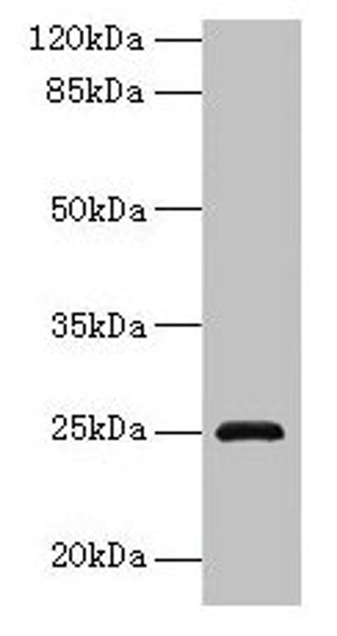 Western blot. All lanes: RAB32 antibody at 3µg/ml + Mouse kidney tissue. Secondary. Goat polyclonal to rabbit IgG at 1/10000 dilution. Predicted band size: 25 kDa. Observed band size: 25 kDa