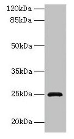 Western blot. All lanes: RAB32 antibody at 3µg/ml + Mouse kidney tissue. Secondary. Goat polyclonal to rabbit IgG at 1/10000 dilution. Predicted band size: 25 kDa. Observed band size: 25 kDa