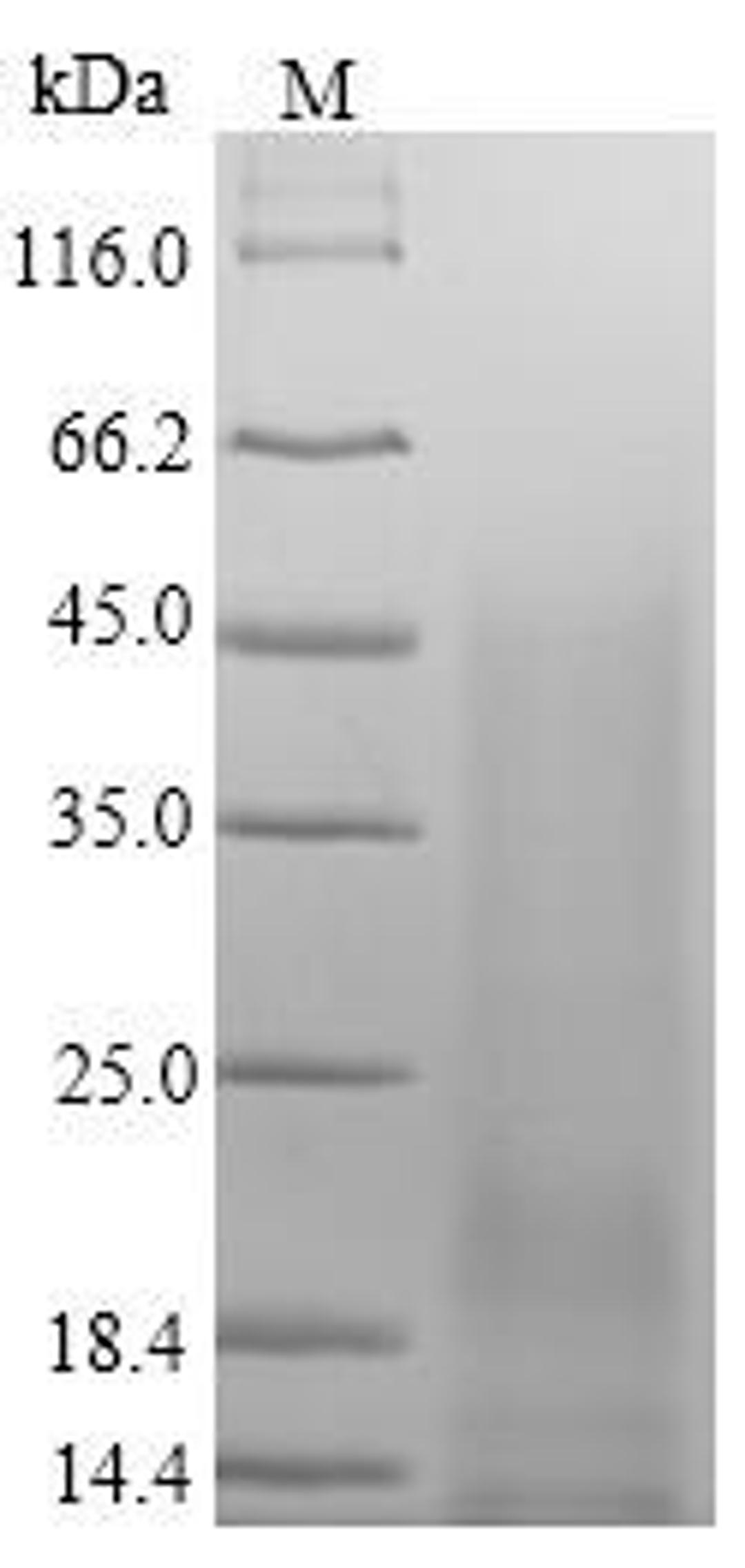 (Tris-Glycine gel) Discontinuous SDS-PAGE (reduced) with 5% enrichment gel and 15% separation gel.