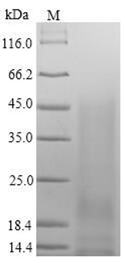 (Tris-Glycine gel) Discontinuous SDS-PAGE (reduced) with 5% enrichment gel and 15% separation gel.