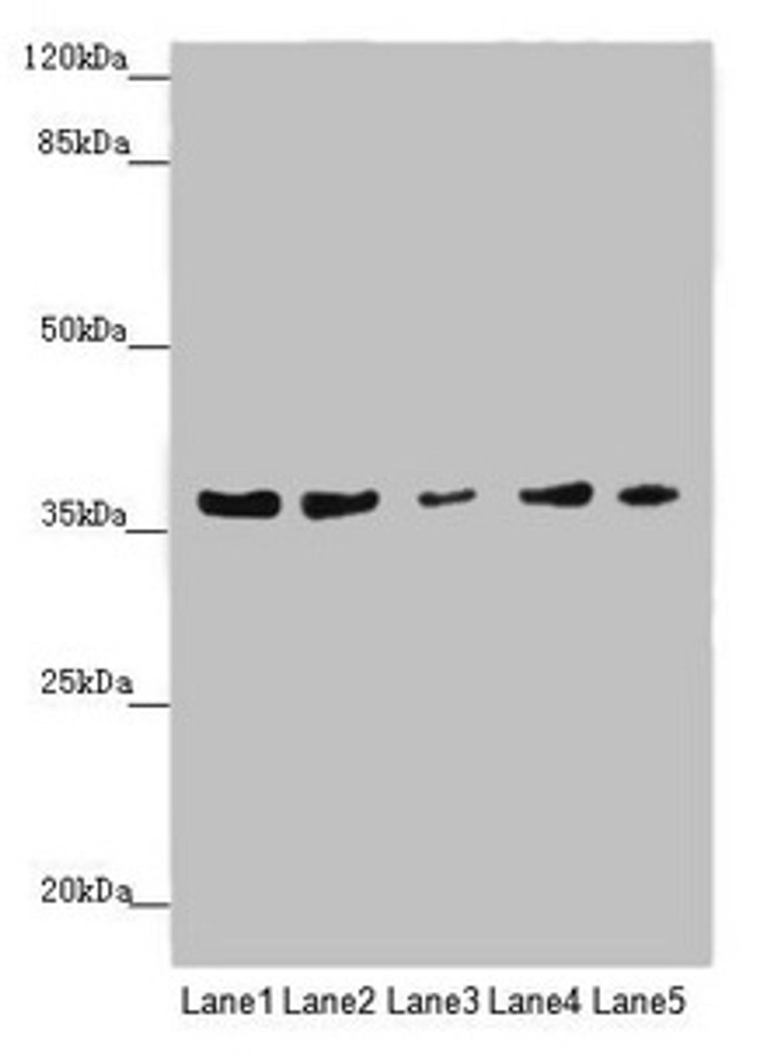 Western blot. All lanes: MTHFD2 antibody at 4.99µg/ml. Lane 1: 293 whole cell lysate. Lane 2: A431 whole cell lysate. Lane 3: HepG2 whole cell lysate. Lane 4: Hela whole cell lysate. Lane 5: K562 whole cell lysate. Secondary. Goat polyclonal to rabbit IgG at 1/10000 dilution. Predicted band size: 38, 27 kDa. Observed band size: 38 kDa