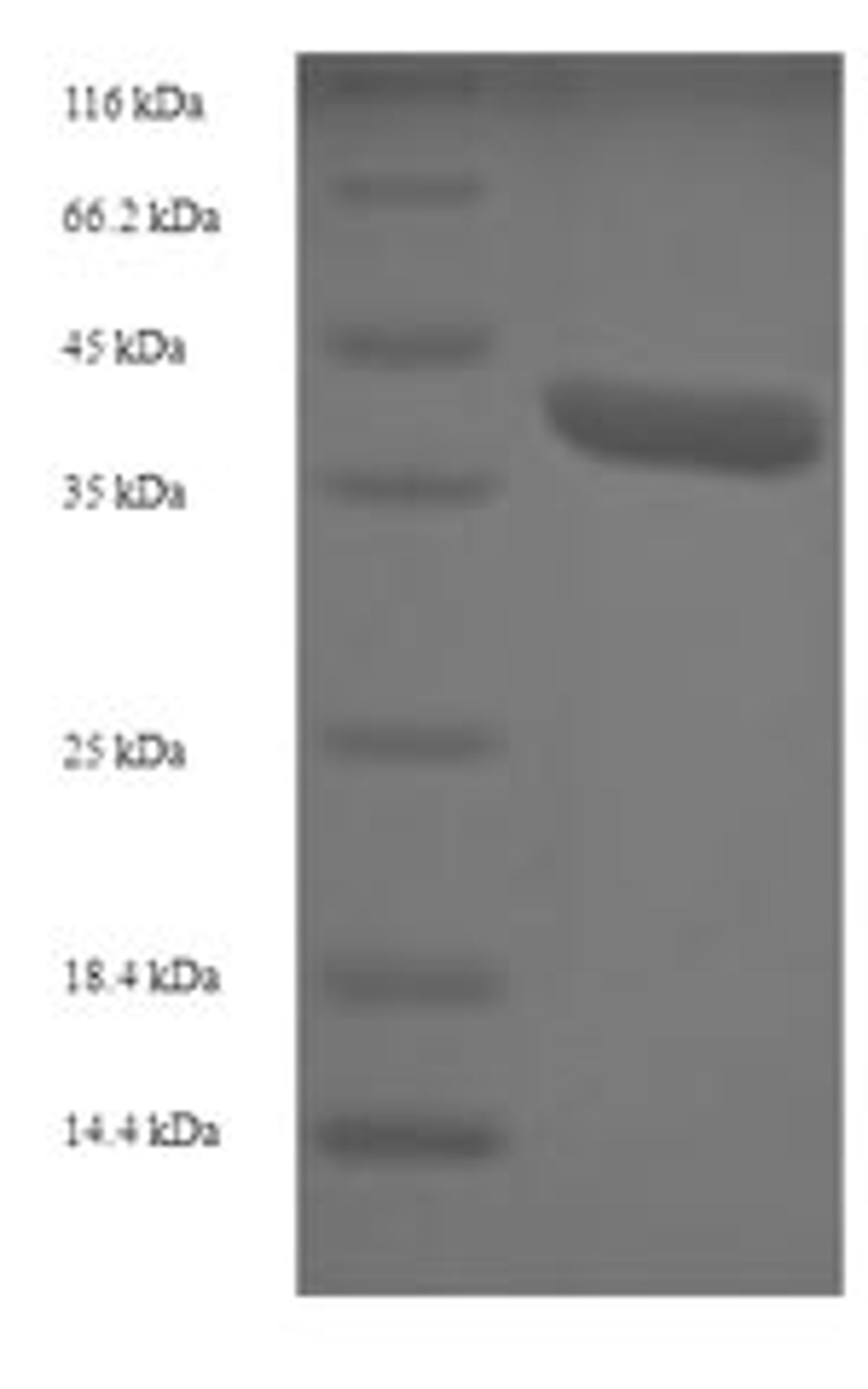 (Tris-Glycine gel) Discontinuous SDS-PAGE (reduced) with 5% enrichment gel and 15% separation gel.