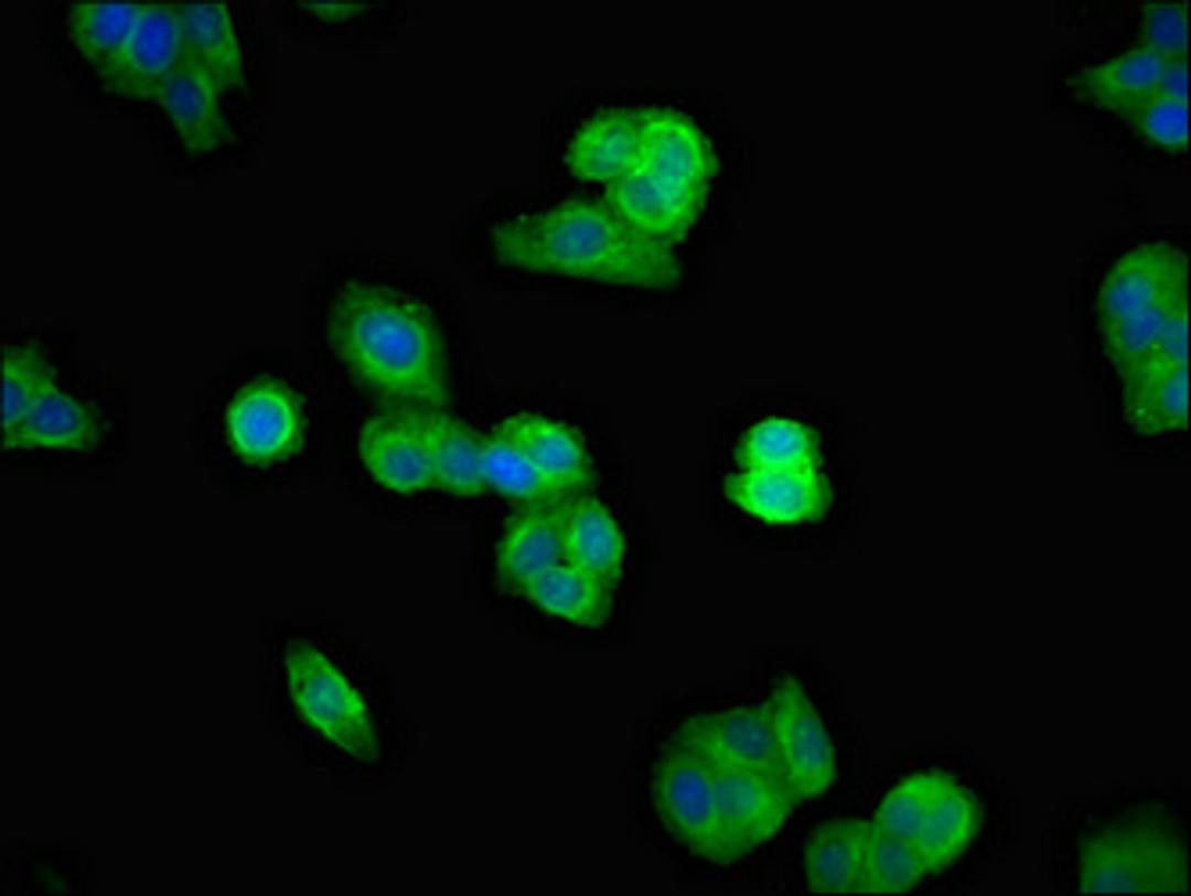 Immunofluorescent analysis of HepG2 cells using CSB-PA025427LA01HU at dilution of 1:100 and Alexa Fluor 488-congugated AffiniPure Goat Anti-Rabbit IgG(H+L)
