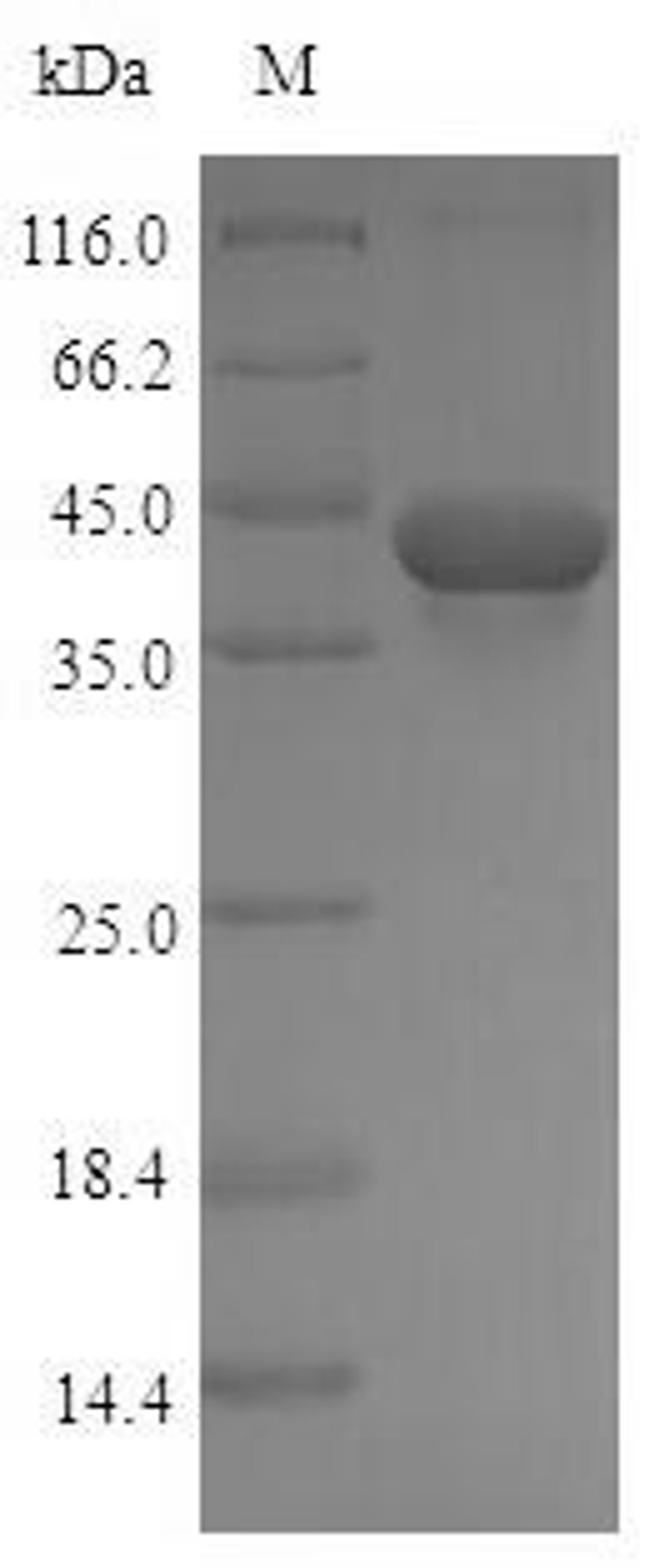 (Tris-Glycine gel) Discontinuous SDS-PAGE (reduced) with 5% enrichment gel and 15% separation gel.
