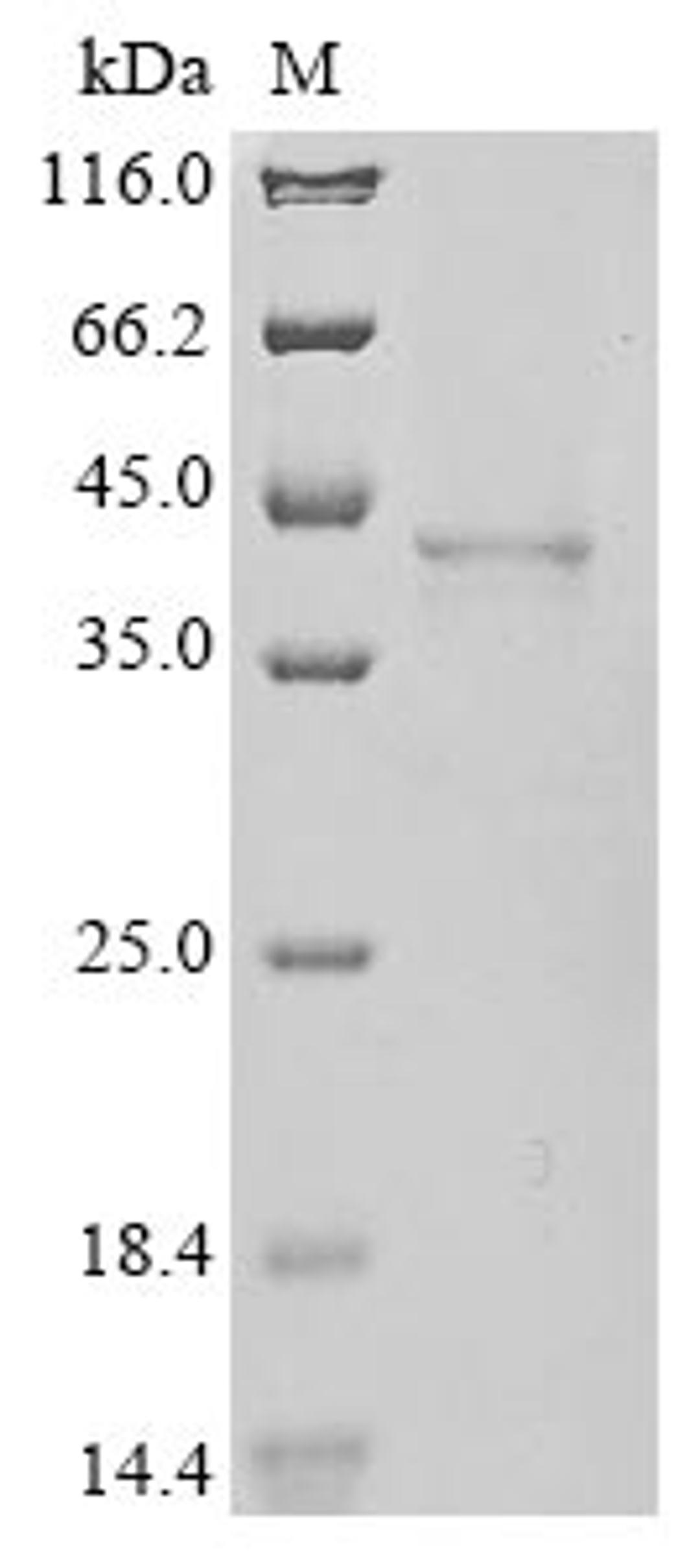 (Tris-Glycine gel) Discontinuous SDS-PAGE (reduced) with 5% enrichment gel and 15% separation gel.