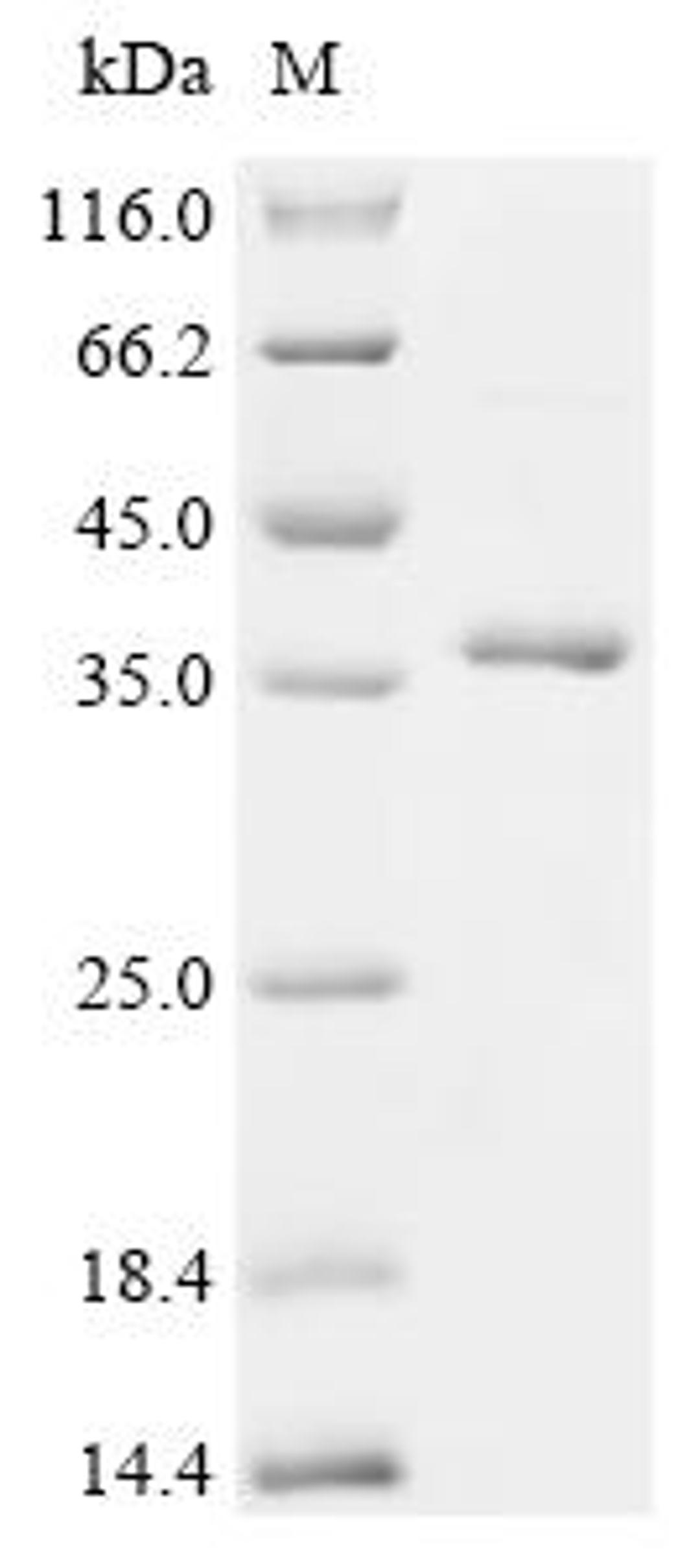 (Tris-Glycine gel) Discontinuous SDS-PAGE (reduced) with 5% enrichment gel and 15% separation gel.