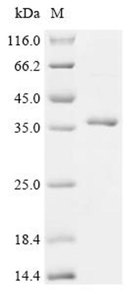 (Tris-Glycine gel) Discontinuous SDS-PAGE (reduced) with 5% enrichment gel and 15% separation gel.