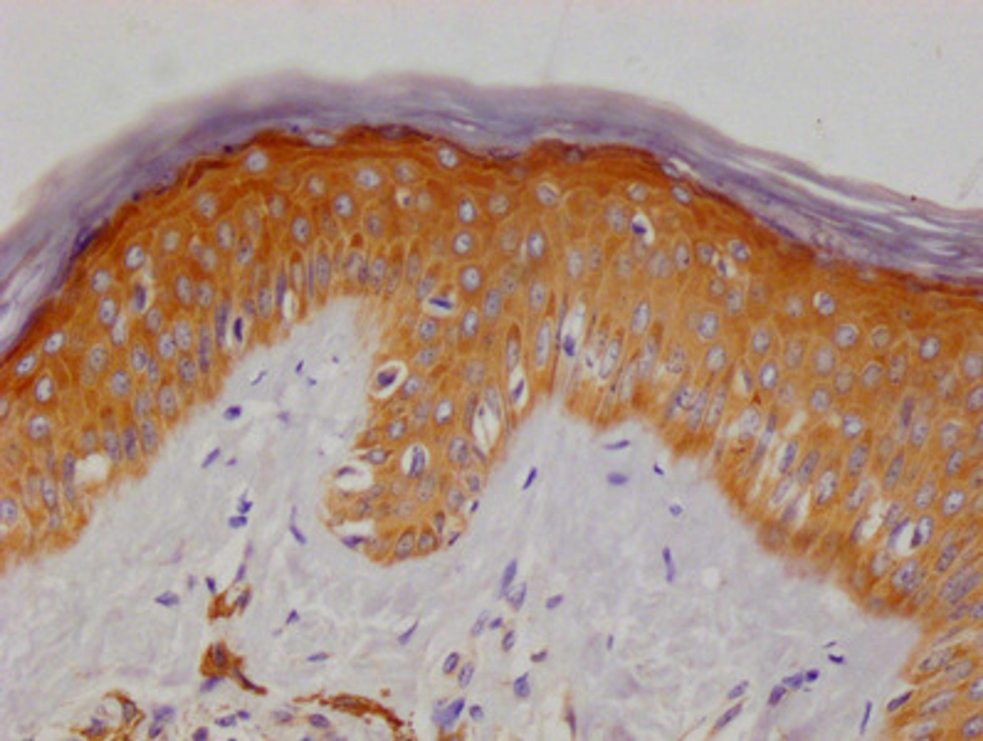 IHC image of CSB-MA731035A0m diluted at 1:50 and staining in paraffin-embedded human skin tissue performed on a Leica BondTM system. After dewaxing and hydration, antigen retrieval was mediated by high pressure in a citrate buffer (pH 6.0). Section was blocked with 10% normal goat serum 30min at RT. Then primary antibody (1% BSA) was incubated at 4°C overnight. The primary is detected by a biotinylated secondary antibody and visualized using an HRP conjugated SP system.