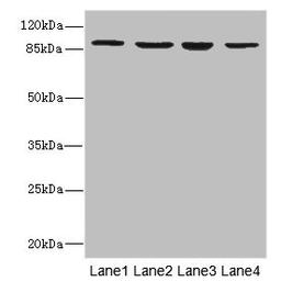Western blot. All lanes: ITGB7 antibody at 5.04ug/ml. Lane 1: MCF-7 whole cell lysate. Lane 2: HepG2 whole cell lysate. Lane 3: A549 whole cell lysate. Lane 4: K562 whole cell lysate. Secondary. Goat polyclonal to rabbit IgG at 1/10000 dilution. Predicted band size: 87, 72 kDa. Observed band size: 87 kDa. 
