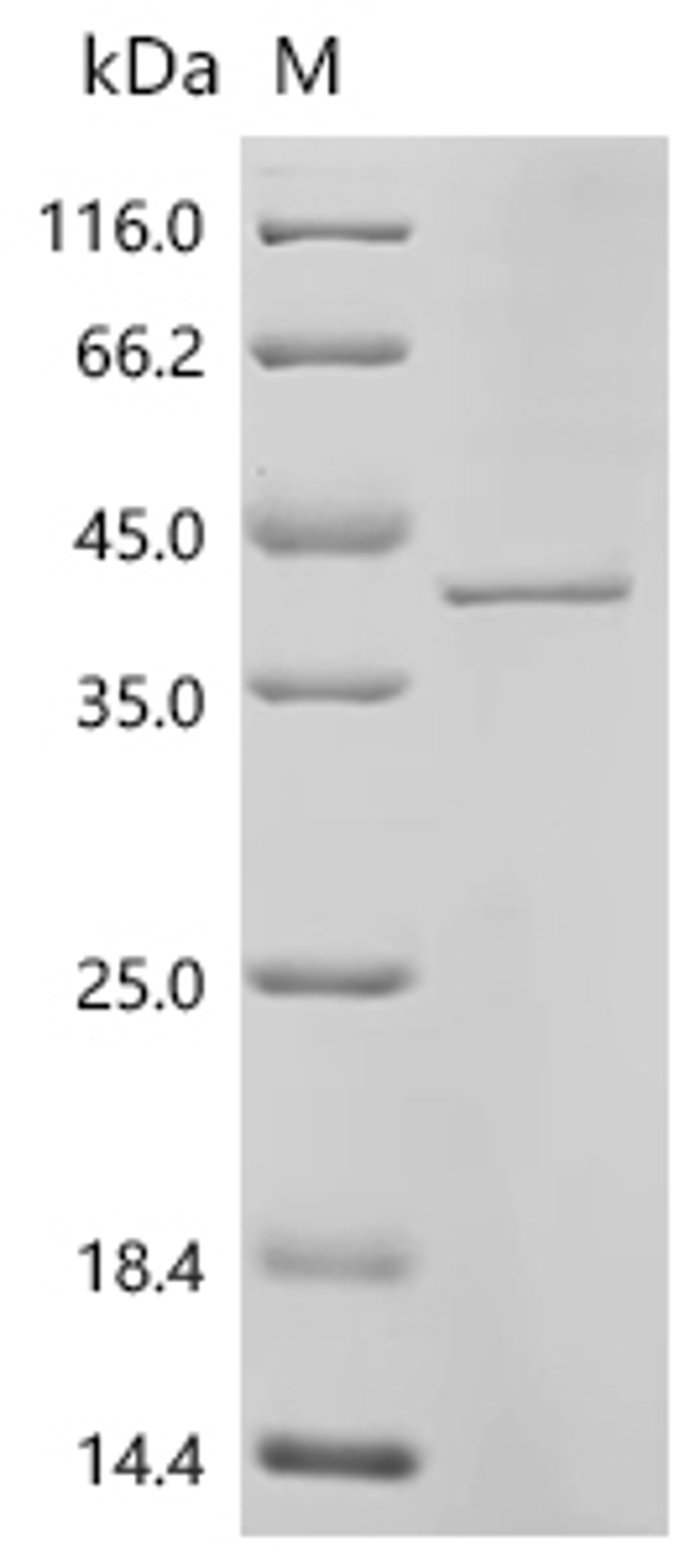 (Tris-Glycine gel) Discontinuous SDS-PAGE (reduced) with 5% enrichment gel and 15% separation gel.