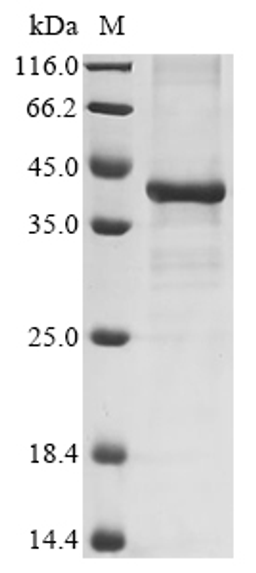 (Tris-Glycine gel) Discontinuous SDS-PAGE (reduced) with 5% enrichment gel and 15% separation gel.