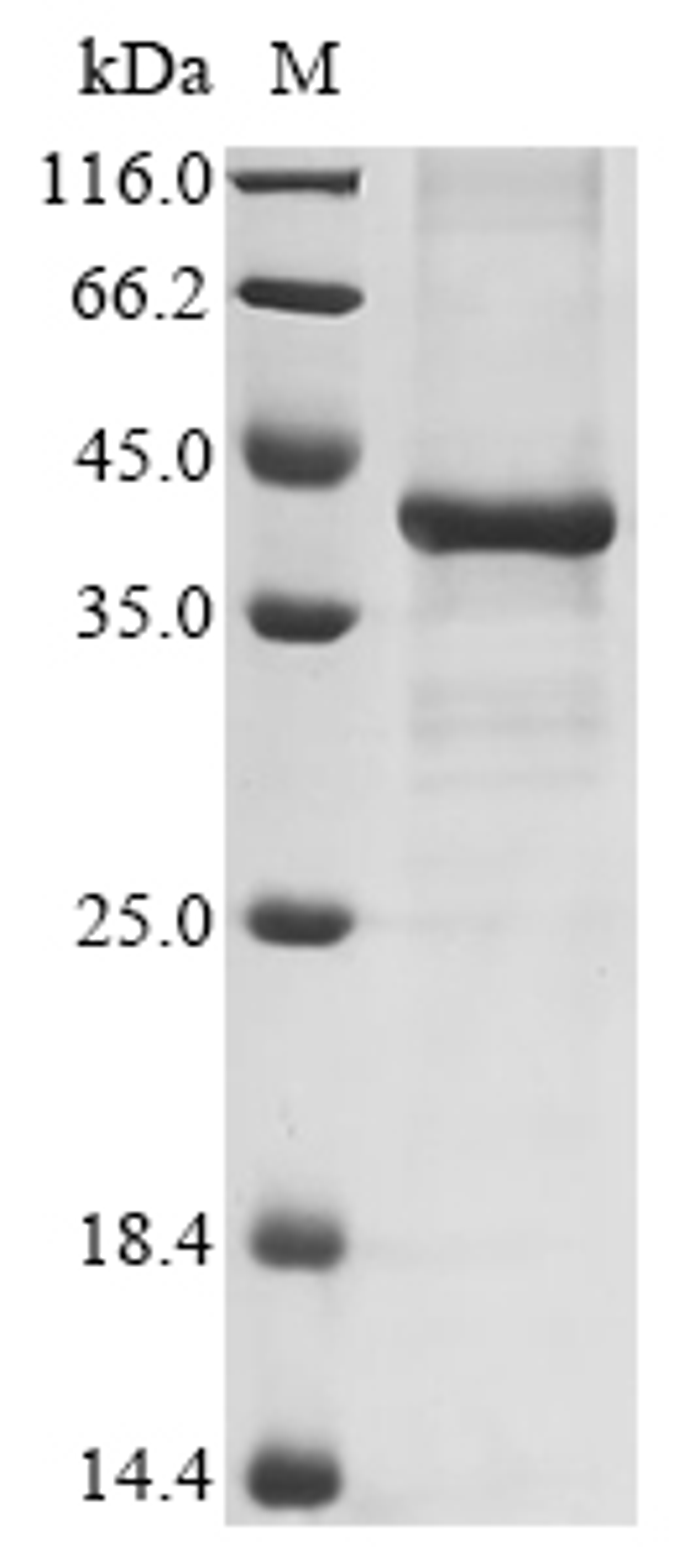 (Tris-Glycine gel) Discontinuous SDS-PAGE (reduced) with 5% enrichment gel and 15% separation gel.