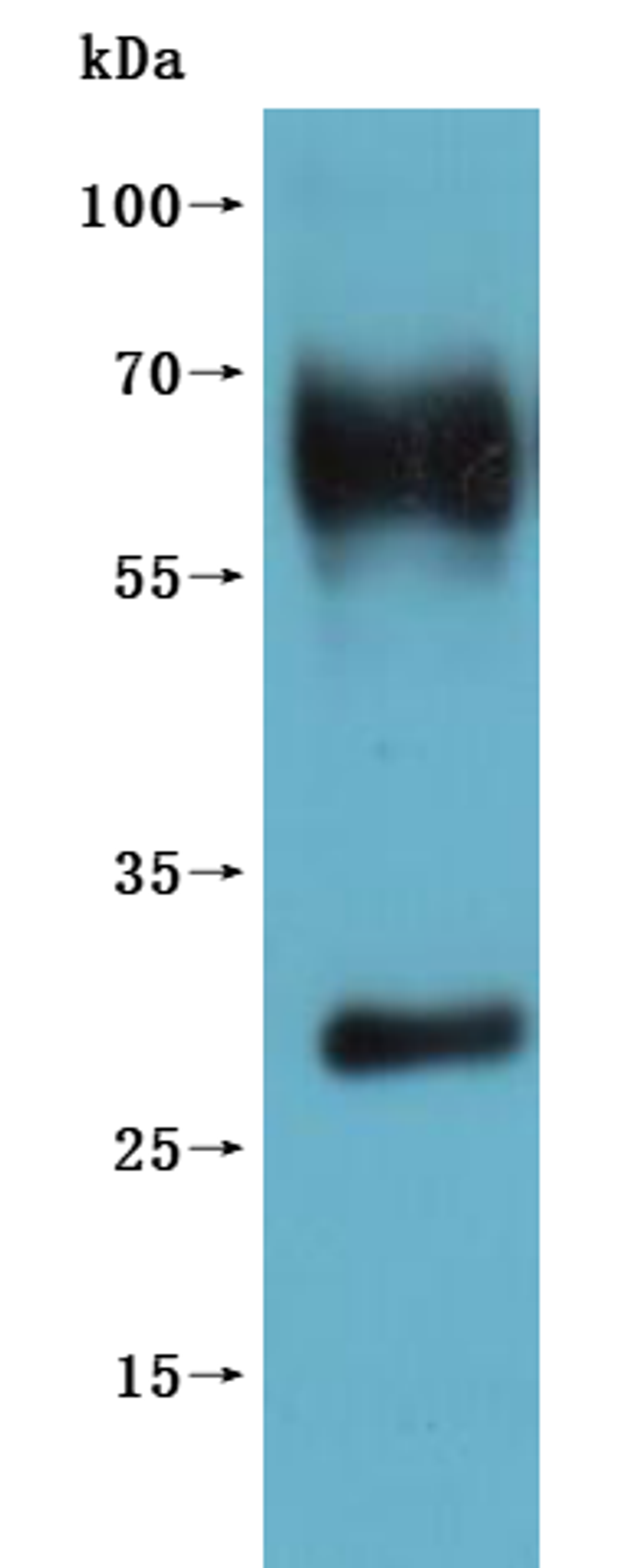 CSB-MP860774HU is detected by Mouse anti-6*His monoclonal antibody.(This tag can be tested only under denaturing conditions.)