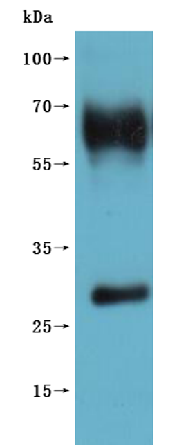 CSB-MP860774HU is detected by Mouse anti-6*His monoclonal antibody.(This tag can be tested only under denaturing conditions.)