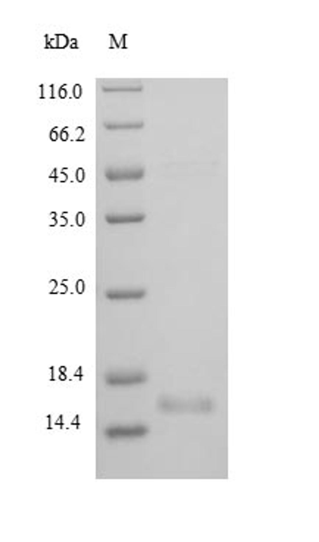 (Tris-Glycine gel) Discontinuous SDS-PAGE (reduced) with 5% enrichment gel and 15% separation gel.