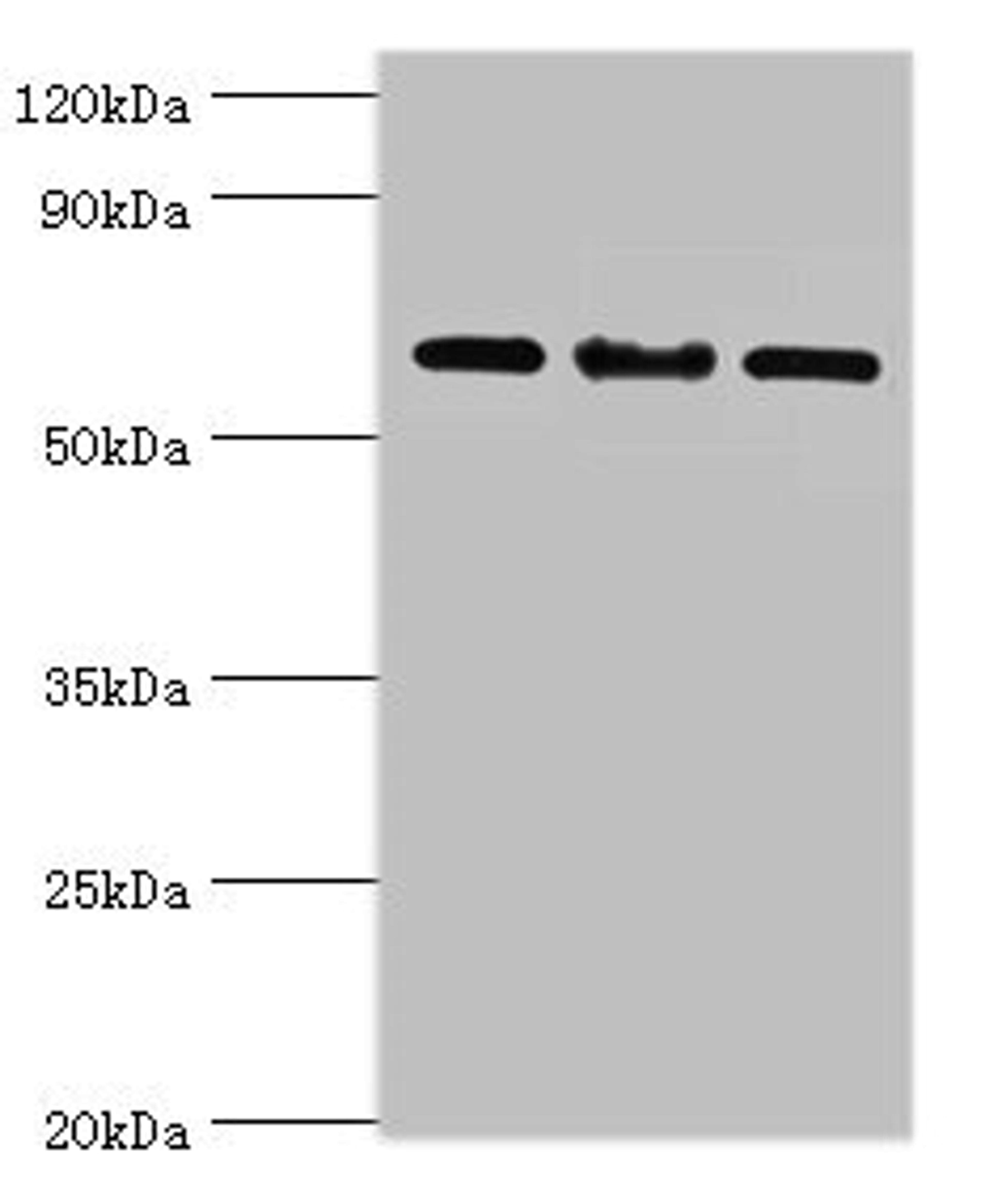 Western blot. All lanes: IL22RA1 antibody at 10ug/ml. Lane 1: Mouse spleen tissue. Lane 2: HepG2 whole cell lysate. Lane 3: 293T whole cell lysate. Secondary. Goat polyclonal to rabbit IgG at 1/10000 dilution. Predicted band size: 63 kDa. Observed band size: 63 kDa.