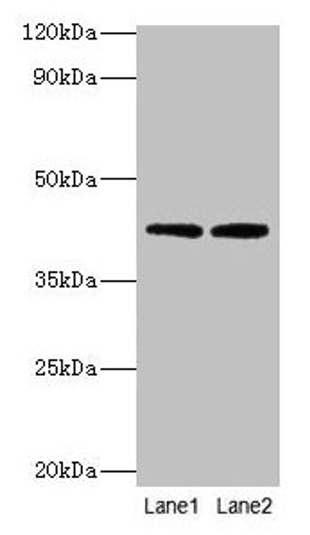 Western blot. All lanes: LIAS antibody at 2µg/ml. Lane 1: MCF-7 whole cell lysate. Lane 2: K562 whole cell lysate. Secondary. Goat polyclonal to rabbit IgG at 1/10000 dilution. Predicted band size: 42, 37, 38  kDa. Observed band size: 42 kDa