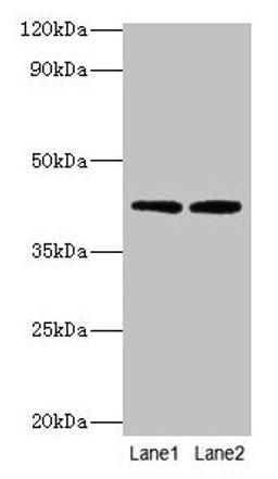 Western blot. All lanes: LIAS antibody at 2µg/ml. Lane 1: MCF-7 whole cell lysate. Lane 2: K562 whole cell lysate. Secondary. Goat polyclonal to rabbit IgG at 1/10000 dilution. Predicted band size: 42, 37, 38  kDa. Observed band size: 42 kDa