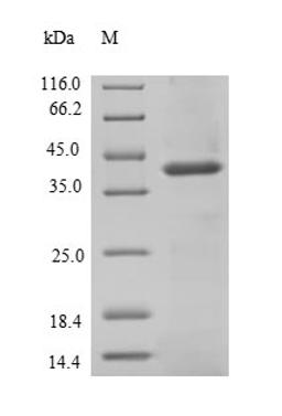 (Tris-Glycine gel) Discontinuous SDS-PAGE (reduced) with 5% enrichment gel and 15% separation gel.