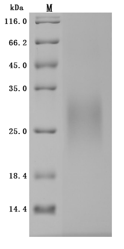 (Tris-Glycine gel) Discontinuous SDS-PAGE (reduced) with 5% enrichment gel and 15% separation gel.