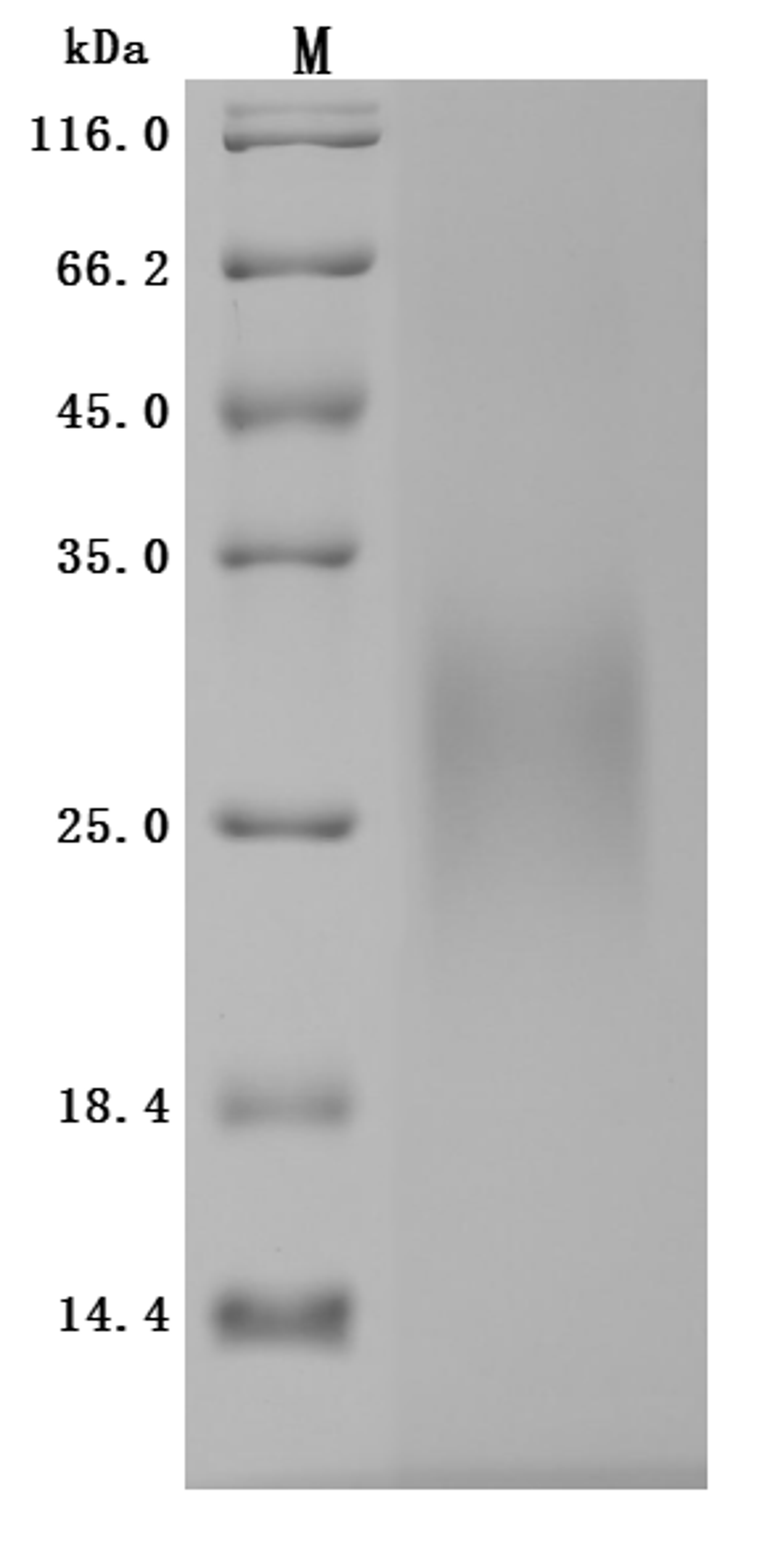 (Tris-Glycine gel) Discontinuous SDS-PAGE (reduced) with 5% enrichment gel and 15% separation gel.
