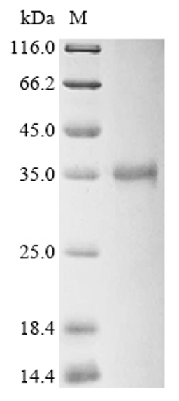 (Tris-Glycine gel) Discontinuous SDS-PAGE (reduced) with 5% enrichment gel and 15% separation gel.