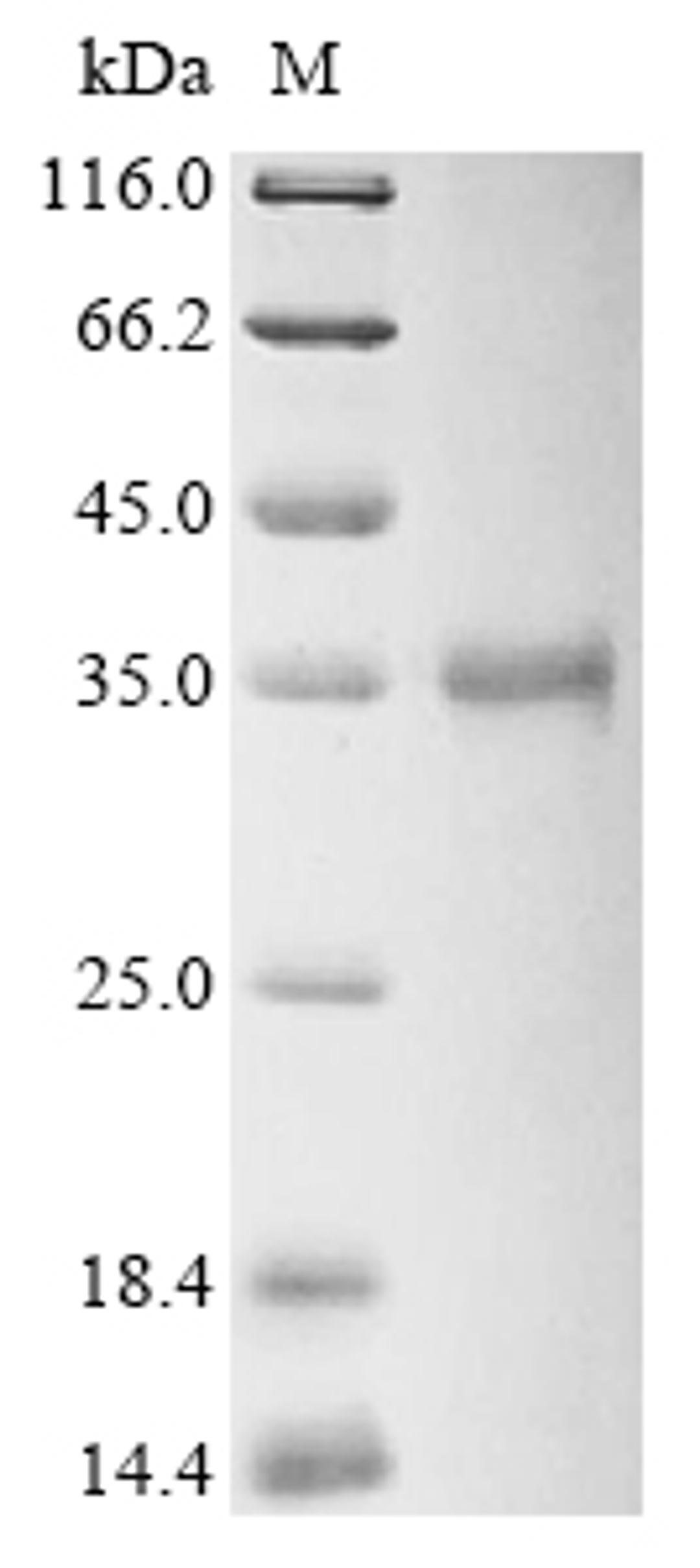 (Tris-Glycine gel) Discontinuous SDS-PAGE (reduced) with 5% enrichment gel and 15% separation gel.