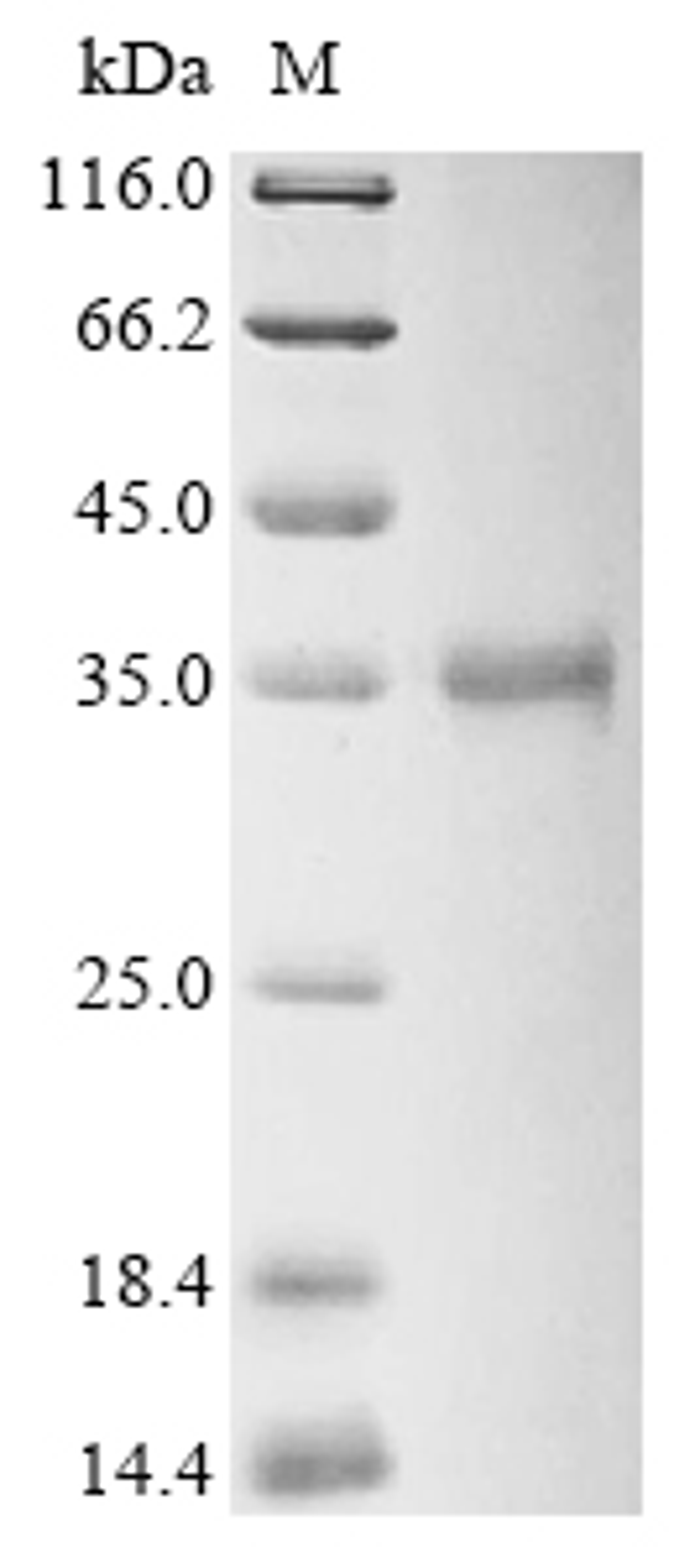 (Tris-Glycine gel) Discontinuous SDS-PAGE (reduced) with 5% enrichment gel and 15% separation gel.