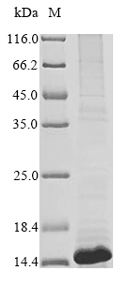 (Tris-Glycine gel) Discontinuous SDS-PAGE (reduced) with 5% enrichment gel and 15% separation gel.