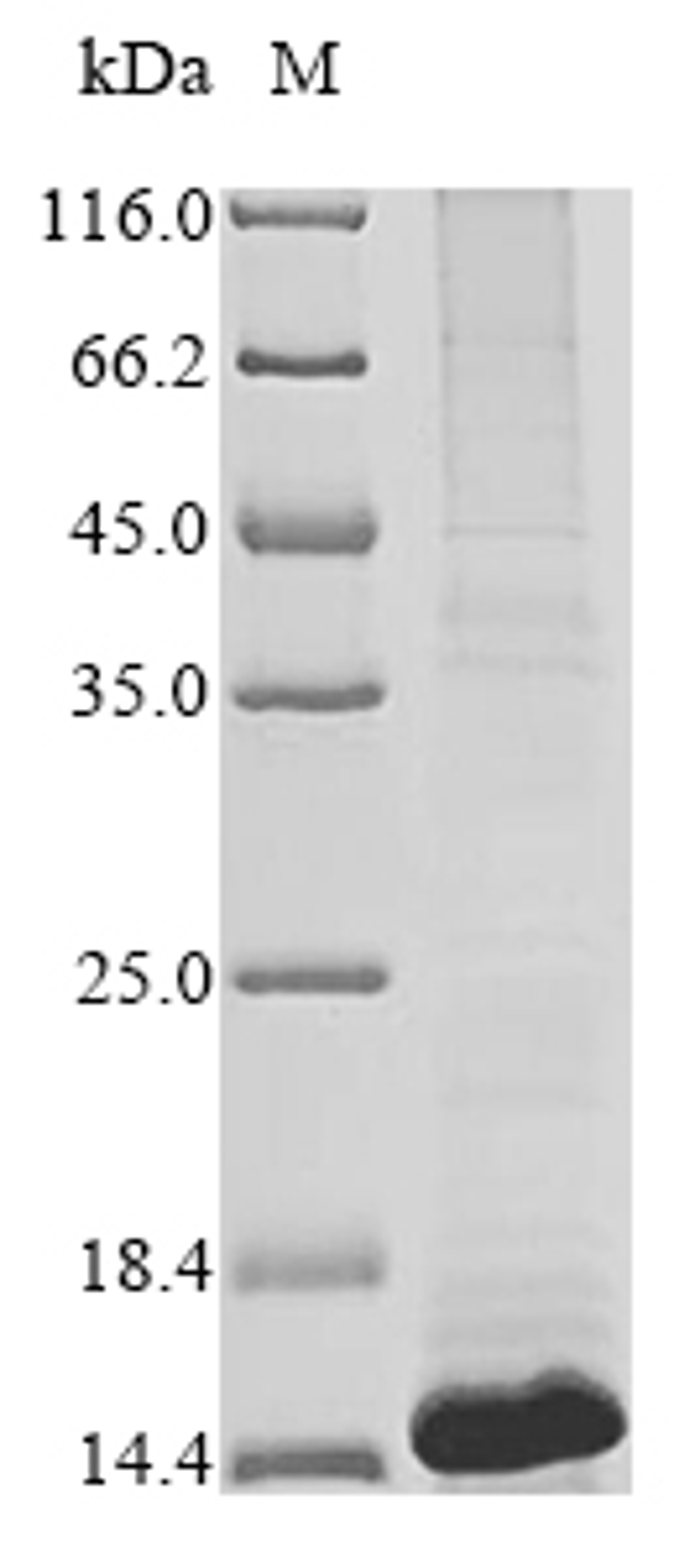 (Tris-Glycine gel) Discontinuous SDS-PAGE (reduced) with 5% enrichment gel and 15% separation gel.