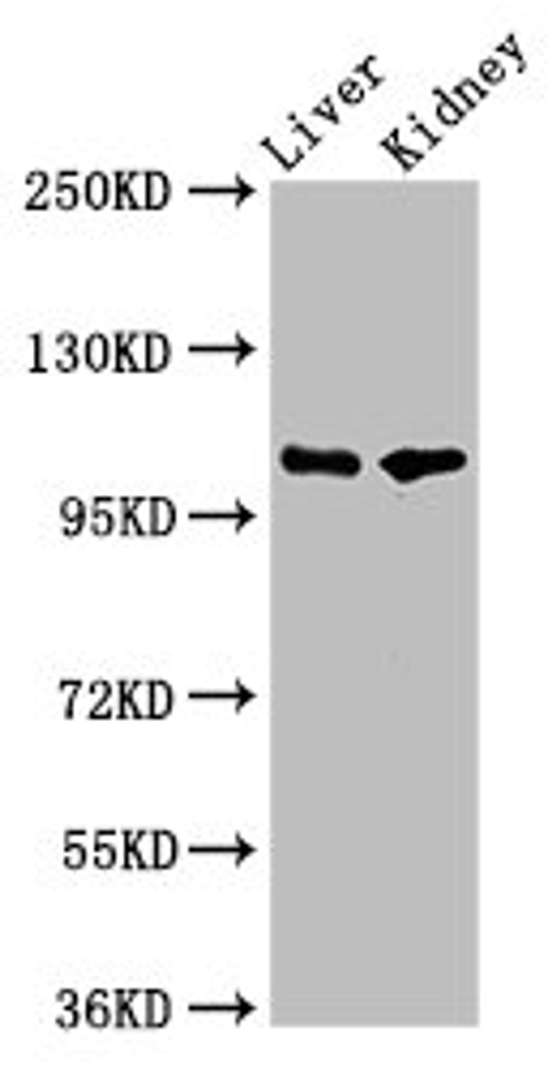 Western Blot. Positive WB detected in: Rat liver tissue, Mouse kidney tissue. All lanes: PEAR1 antibody at 5.2ug/ml. Secondary. Goat polyclonal to rabbit IgG at 1/50000 dilution. Predicted band size: 111 kDa. Observed band size: 111 kDa. 