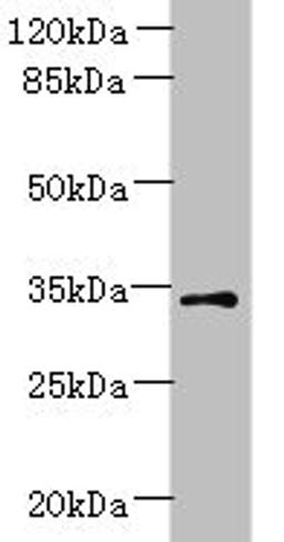 Western blot. All lanes: ZDHHC3 antibody at 1.5ug/ml + Mouse brain tissue. Secondary. Goat polyclonal to rabbit IgG at 1/10000 dilution. Predicted band size: 35, 38 kDa. Observed band size: 35 kDa.