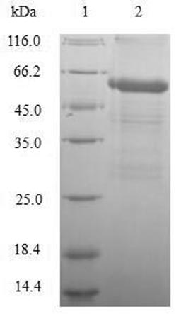 (Tris-Glycine gel) Discontinuous SDS-PAGE (reduced) with 5% enrichment gel and 15% separation gel.
