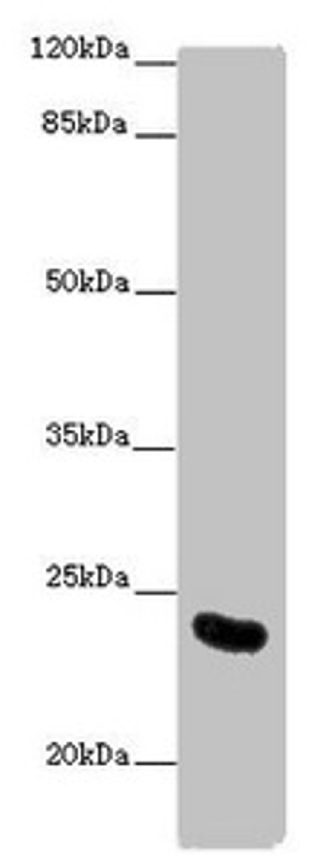 Western blot. All lanes: AICDA antibody at 10 ug/ml + Mouse liver tissue. Secondary. Goat polyclonal to rabbit IgG at 1/10000 dilution. Predicted band size: 24, 23 kDa. Observed band size: 24 kDa. 
