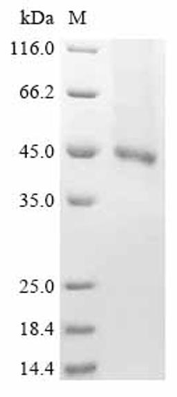 (Tris-Glycine gel) Discontinuous SDS-PAGE (reduced) with 5% enrichment gel and 15% separation gel.