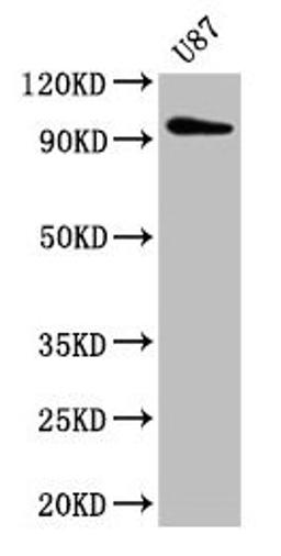 Western Blot. Positive WB detected in: U87 whole cell lysate. All lanes: TTLL6 antibody at 5µg/ml. Secondary. Goat polyclonal to rabbit IgG at 1/50000 dilution. Predicted band size: 97, 65 kDa. Observed band size: 97 kDa