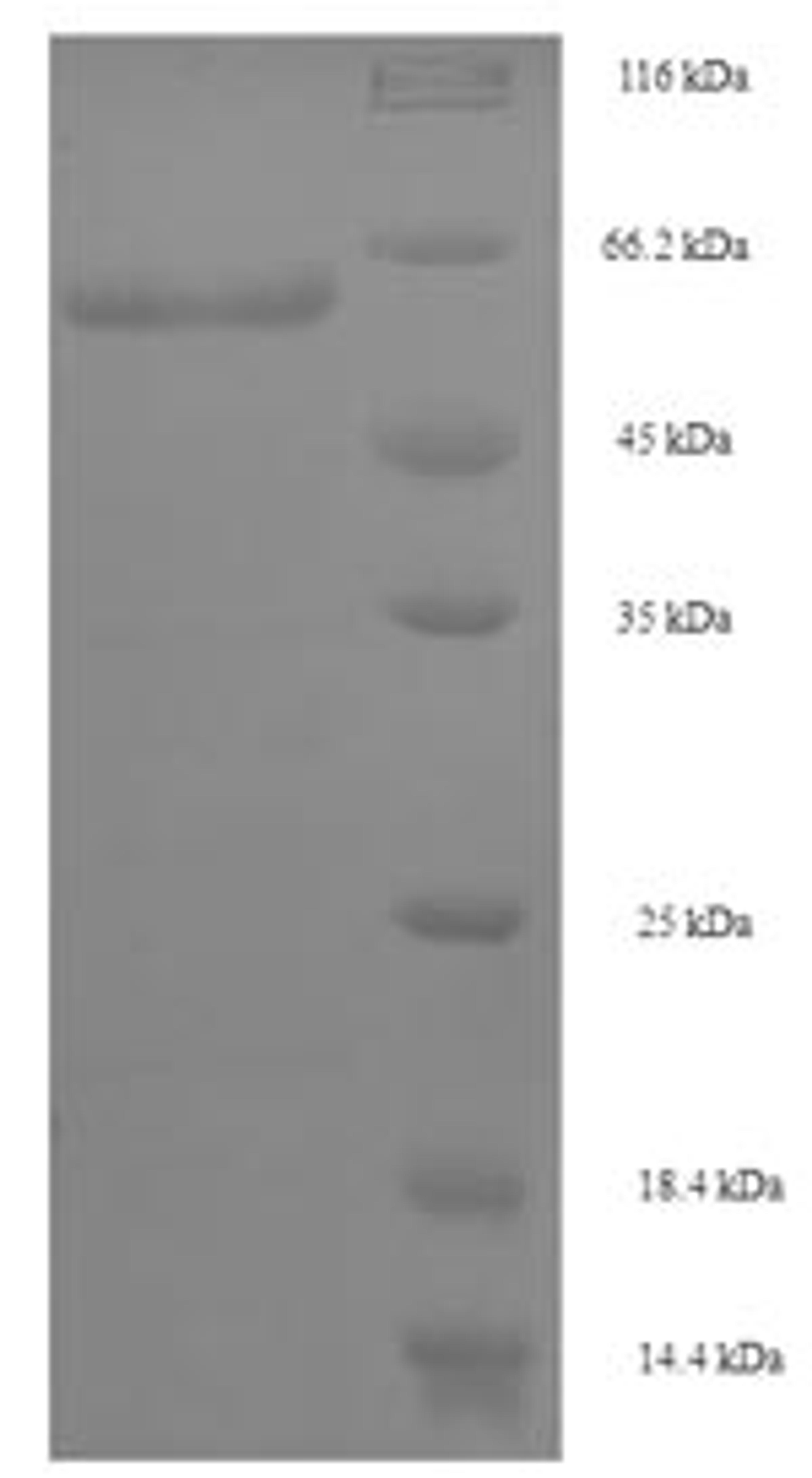 (Tris-Glycine gel) Discontinuous SDS-PAGE (reduced) with 5% enrichment gel and 15% separation gel.